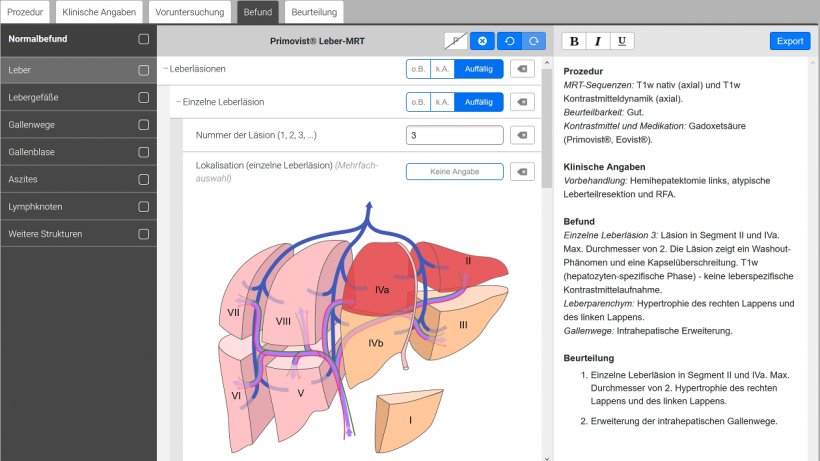 screenshot of liver structured reporting software