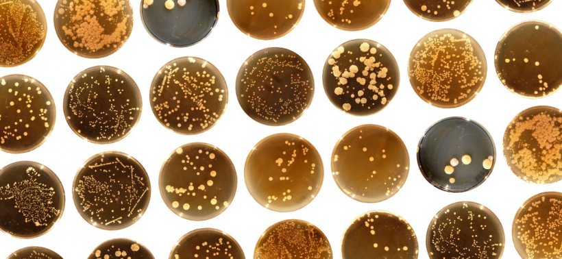 bacteria cultures in petri dishes