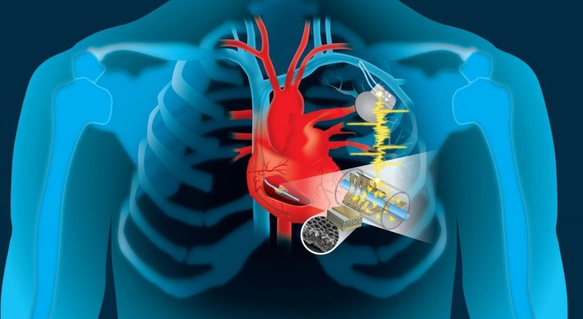 Dartmouth engineers develop dime-sized device to capture and convert the...