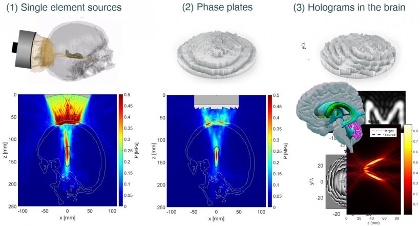 Transcranial ultrasound for therapeutic applications