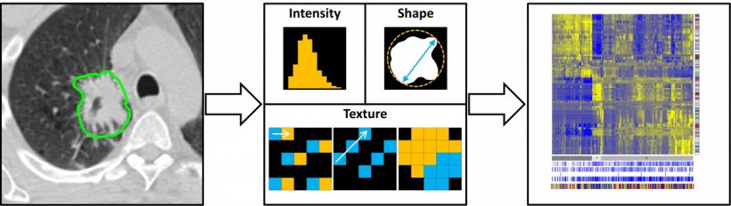 Radiomics on tap in 5-10 years