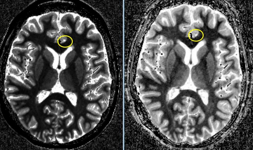 7 Tesla Mr Enters Clinical Routine • Healthcare In 8371