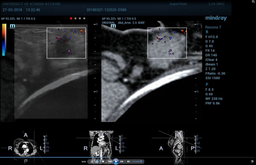 pinpoint doppler ct