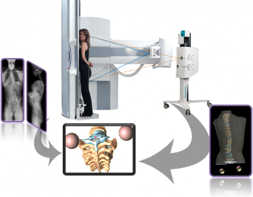 Spinal imaging
