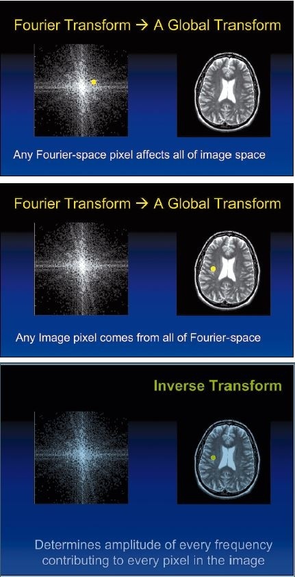 The Fourier transform is a mathematical method to quantitate patterns in an...