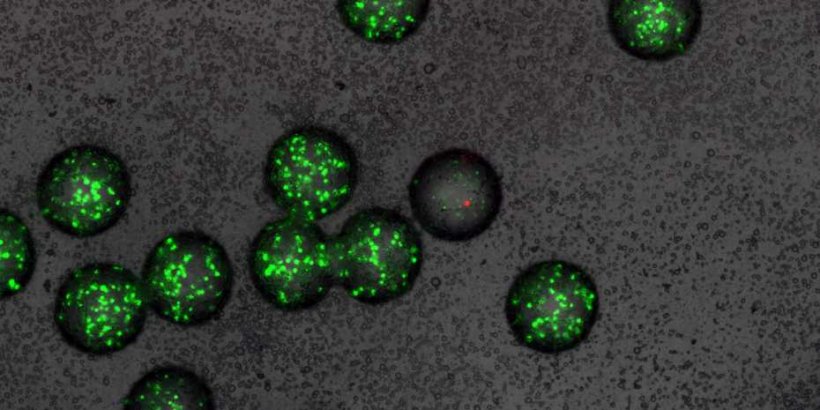 Mikro-Gel-Kügelchen mit grün fluoreszierenden Sensor-Bakterien. In einem der...