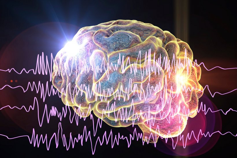 illustration of epilepsy in human brain