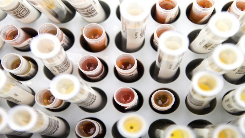 laboratory test tubes filled with various liquids