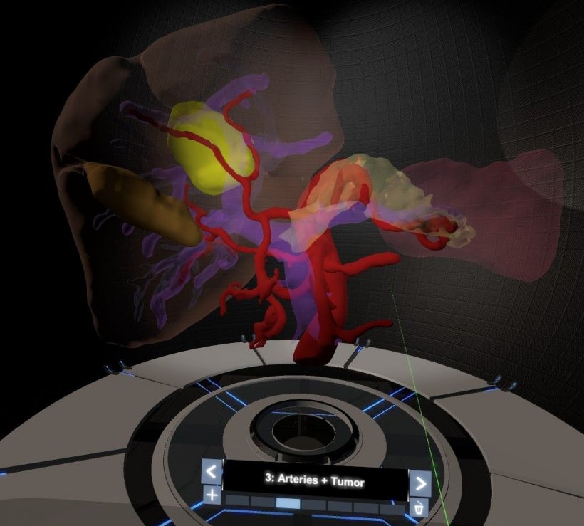 virtual reality display of internal anatomy structures