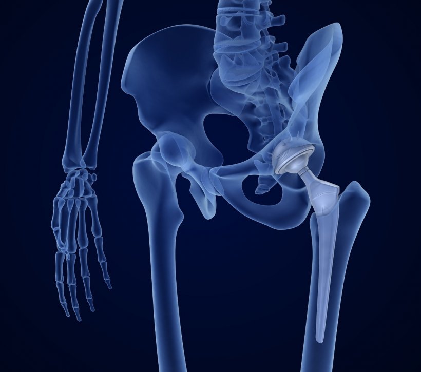Medizinisch genaue 3D-Illustration einer Röntgenaufnahme eines...