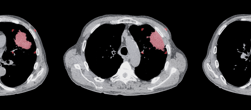 Synapse 3D Medical Imaging  Fujifilm Healthcare Solutions