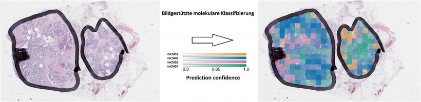 Das imCMS Modell kann die molekulare Klassifikation jeder einzelnen Bildregion...