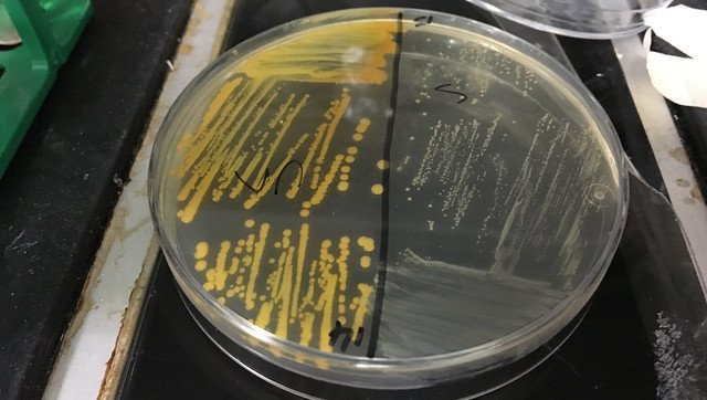 Cigarette smoke accelerates the emergence of antibiotic resistant Small Colony...