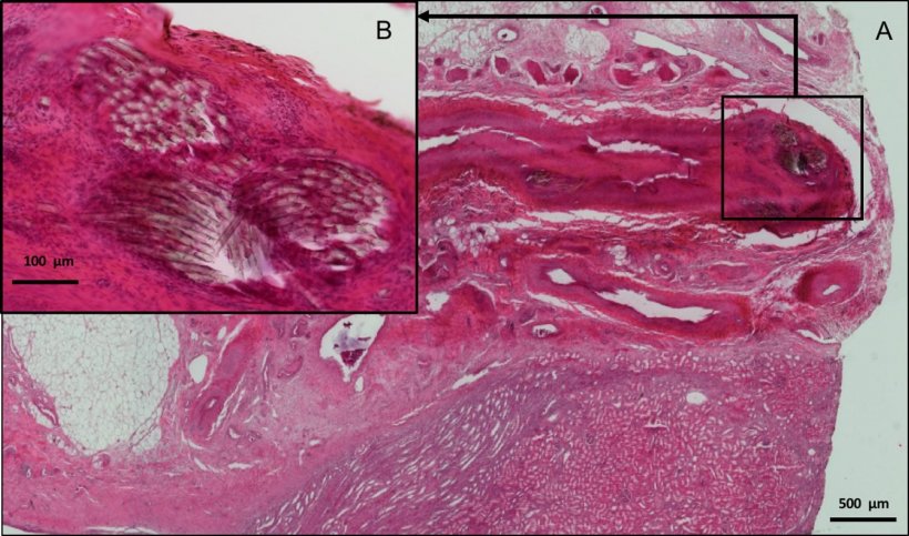 A Light microscopy (9 2): centered on NAS without perivascular inflammatory...