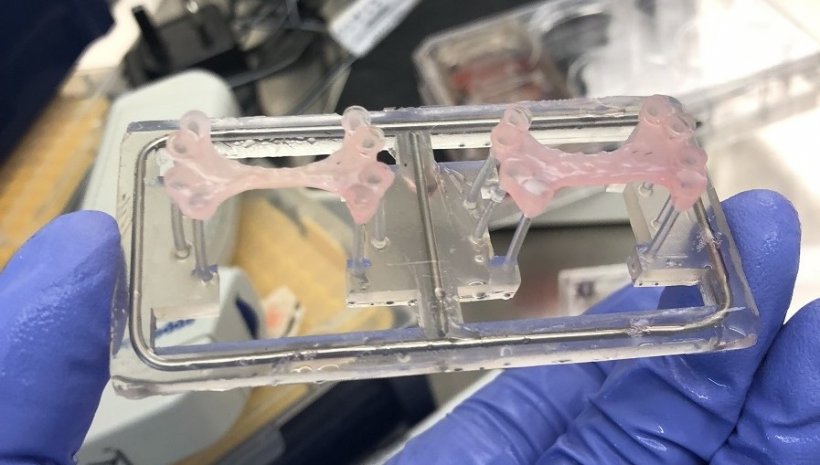 These bioengineered patches could drastically speed up recovery after a heart...