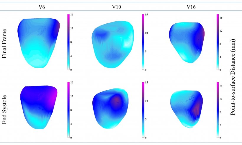 Displacement comparison at the end-systolic frame and final frame. The three...