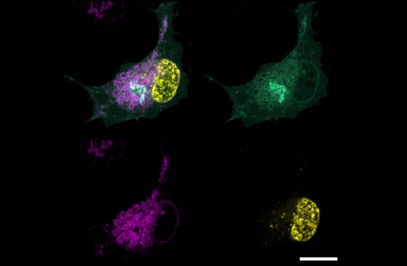 Localization of FSP1 in green, cell nucleus in yellow, endoplasmic reticulum in...