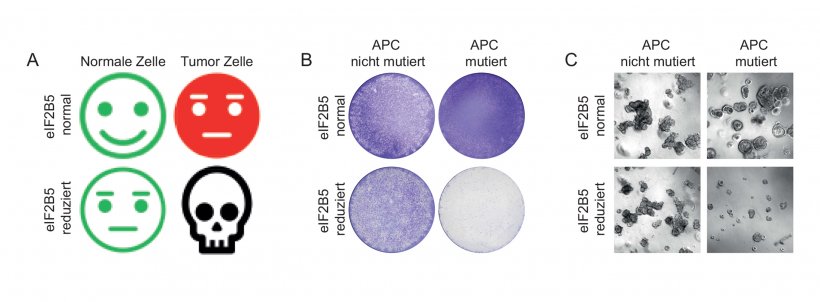 Wird das Gen elF2B5 gehemmt, bekommt das Darmkrebszellen mit einer APC-Mutation...