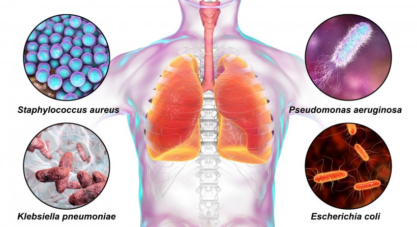 Human respiratory pathogens, bacteria that cause nosocomial pneumonia, 3D...