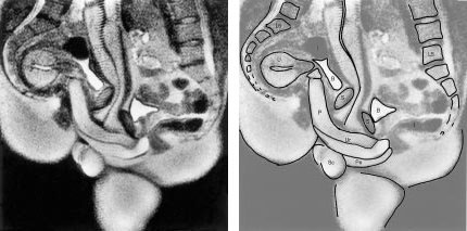 Midsagittal image of the anatomy of sexual intercourse (experiment 12)....