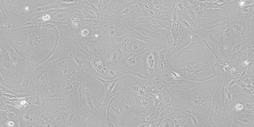 iPSC-derived thymic epithelial cells imaged by phase-contrast microscopy.