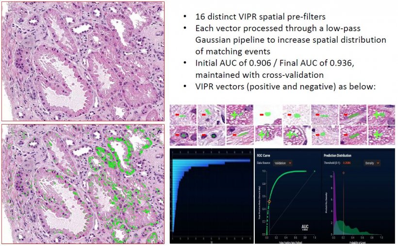 Example 2: Renal tubule vacuolization classifier