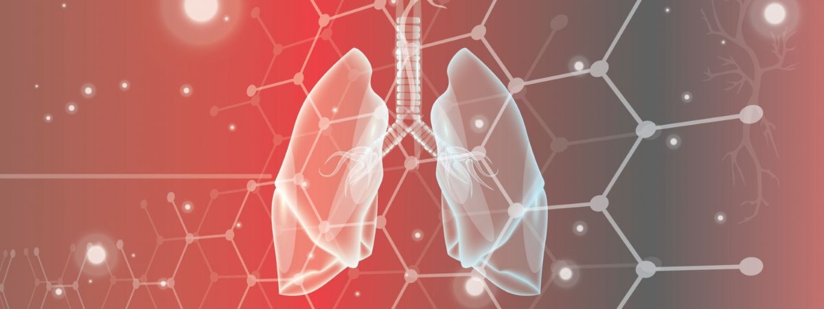 A more reliable way to early detect lung tumours •