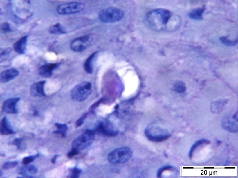 Entamoeba gingivalis parasite amoeba