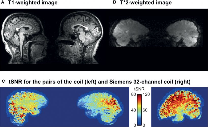 Representative single-dyad T1 (A) and T*2 (B) -weighted images acquired with...
