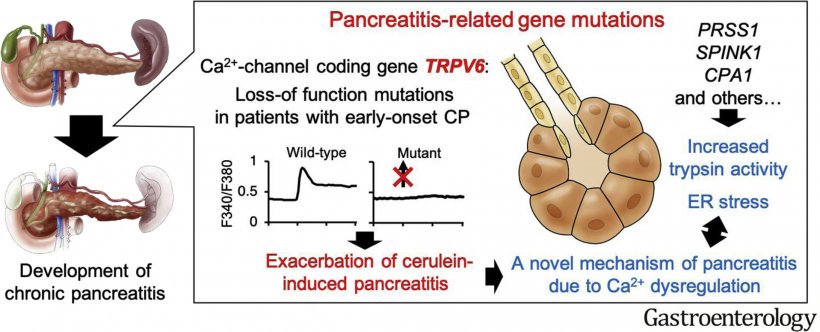Genetische Veränderungen im Calciumkanal TRPV6 sind global mit der Entstehung...