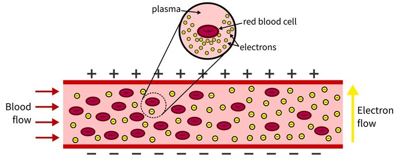 This diagram depicts the way conductivity will change as blood cells break. The...