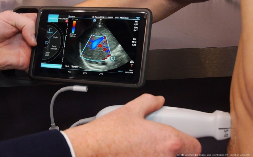 The SonoSite iViz ultrasound system.