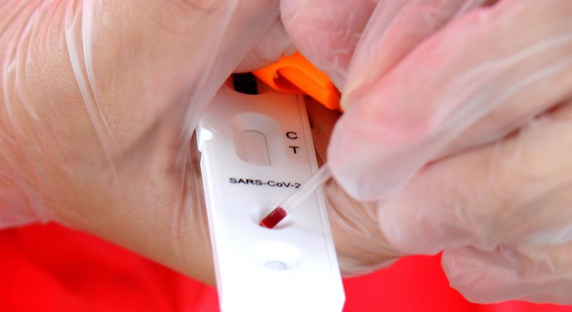 Health worker conducting a SARS-CoV-2 antibody test in Brasil (symbol photo)