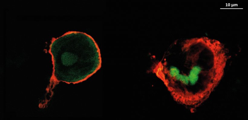 Images of macrophages (red) in which the active substance (green) is...