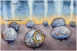 Veszikel: Schädigung durch Alpha-Synuclein