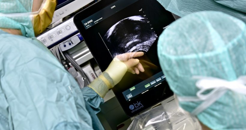 Prostata-OP: Überwachung der Gewebeentnahme per Ultraschall