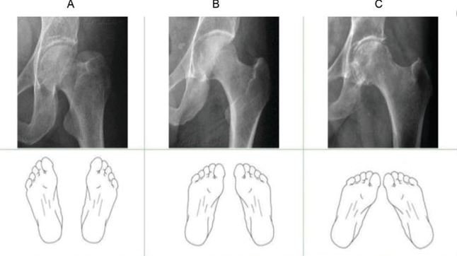 An Overview of Patient Positioning in Healthcare