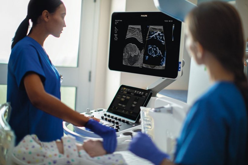 Philips erste Ultraschall-Lösung für die Pädiatrie bietet vier Spezialsonden...