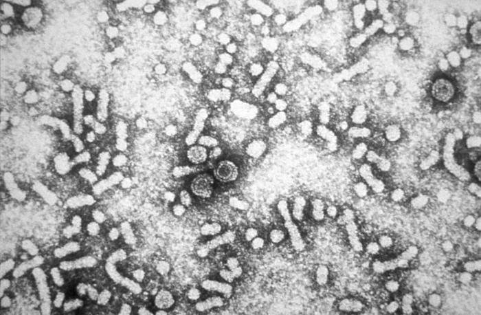 Electron micrograph of hepatitis B virus