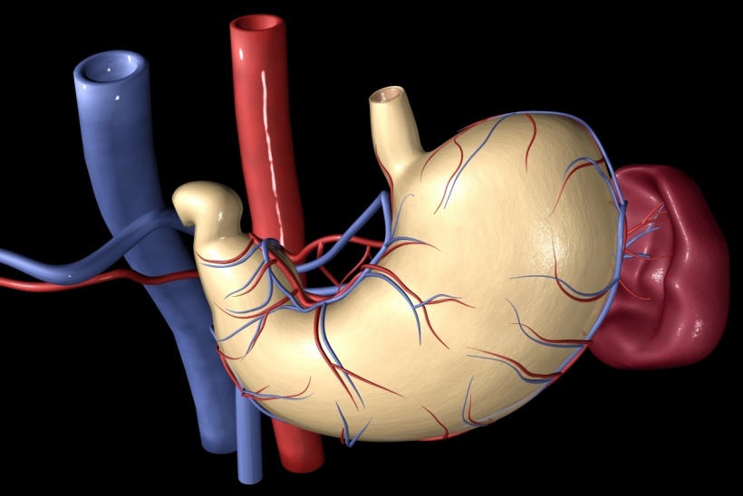Bariatric arterial embolisation