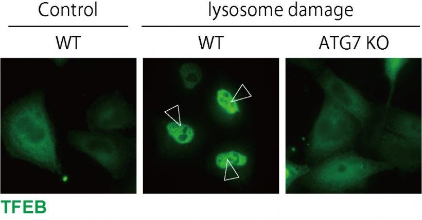 LC3 lipidation is essential for TFEB activation. TFEB is localized to the...