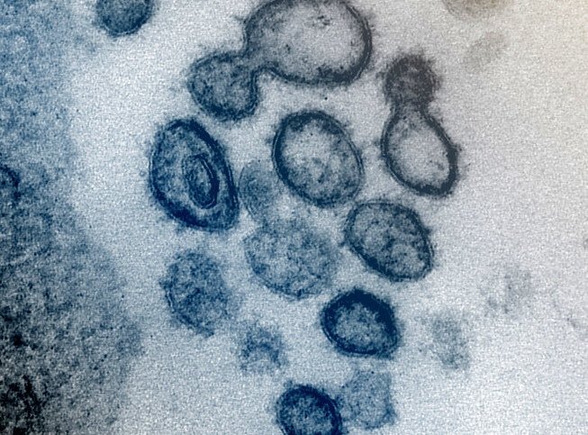 This transmission electron microscope image shows SARS-CoV-2 , the virus that...