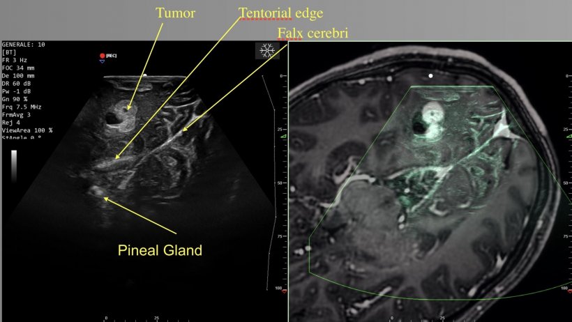 Real-time images for anatomical landmarks identification