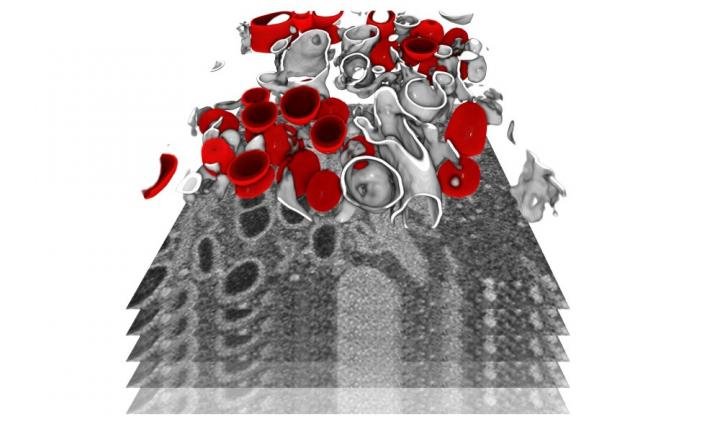 Infected cells were imaged by focused ion beam scanning electron microscopy, a...