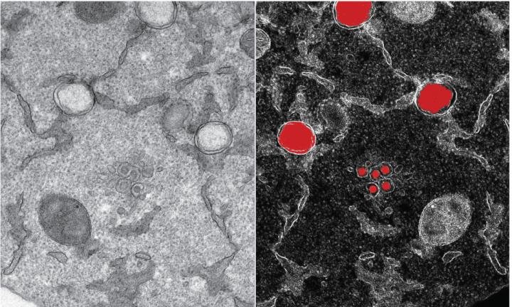 A portion of an infected cell is observed by transmission electron microscopy,...