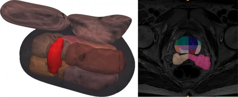 Left: Detailed 3D reconstruction of the prostate showing different regions and...