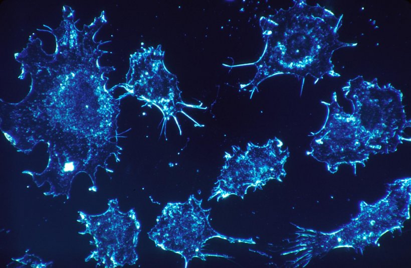 Cancer cells.