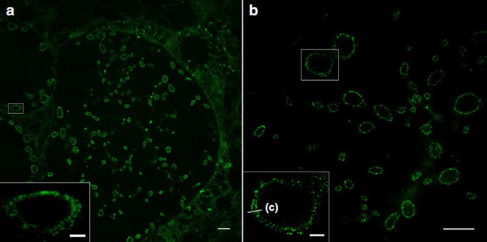 Sphingolipid expansion microscopy (ExM) of tenfold expanded cells infected with...
