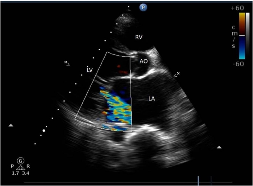 Echocardiography: Ultrasound examination of the heart.