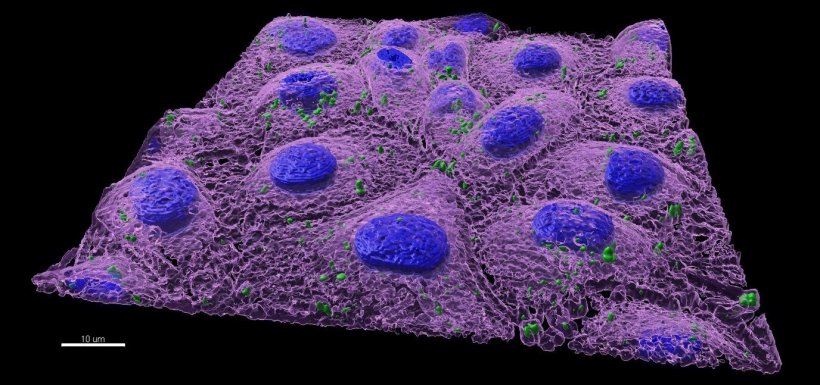 Nanoplastics (in green) inside a zebra fish cell